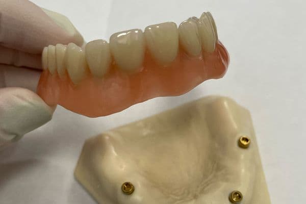 Zahnersatz Prothese
